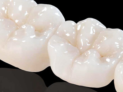 Metal Free Crowns, Ceramic, Zirconia 